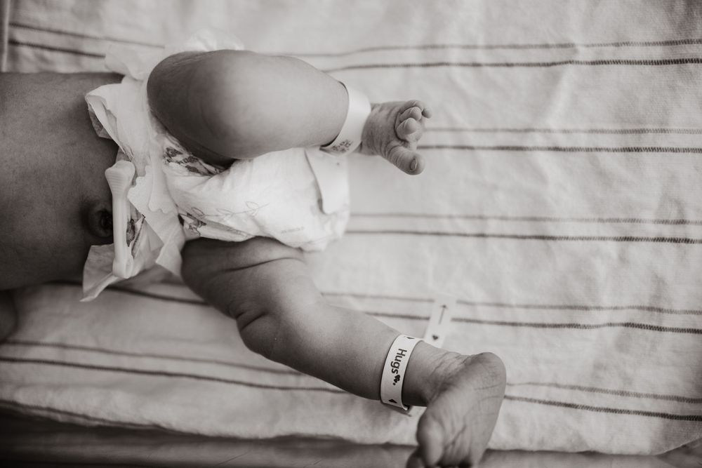 Black and white photo of a newborn baby lying on a striped blanket wearing a diaper and hospital ID bracelet.