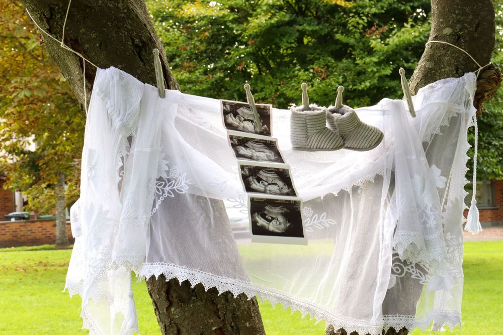 White cloth draped between trees with ultrasound photos displayed in a line.