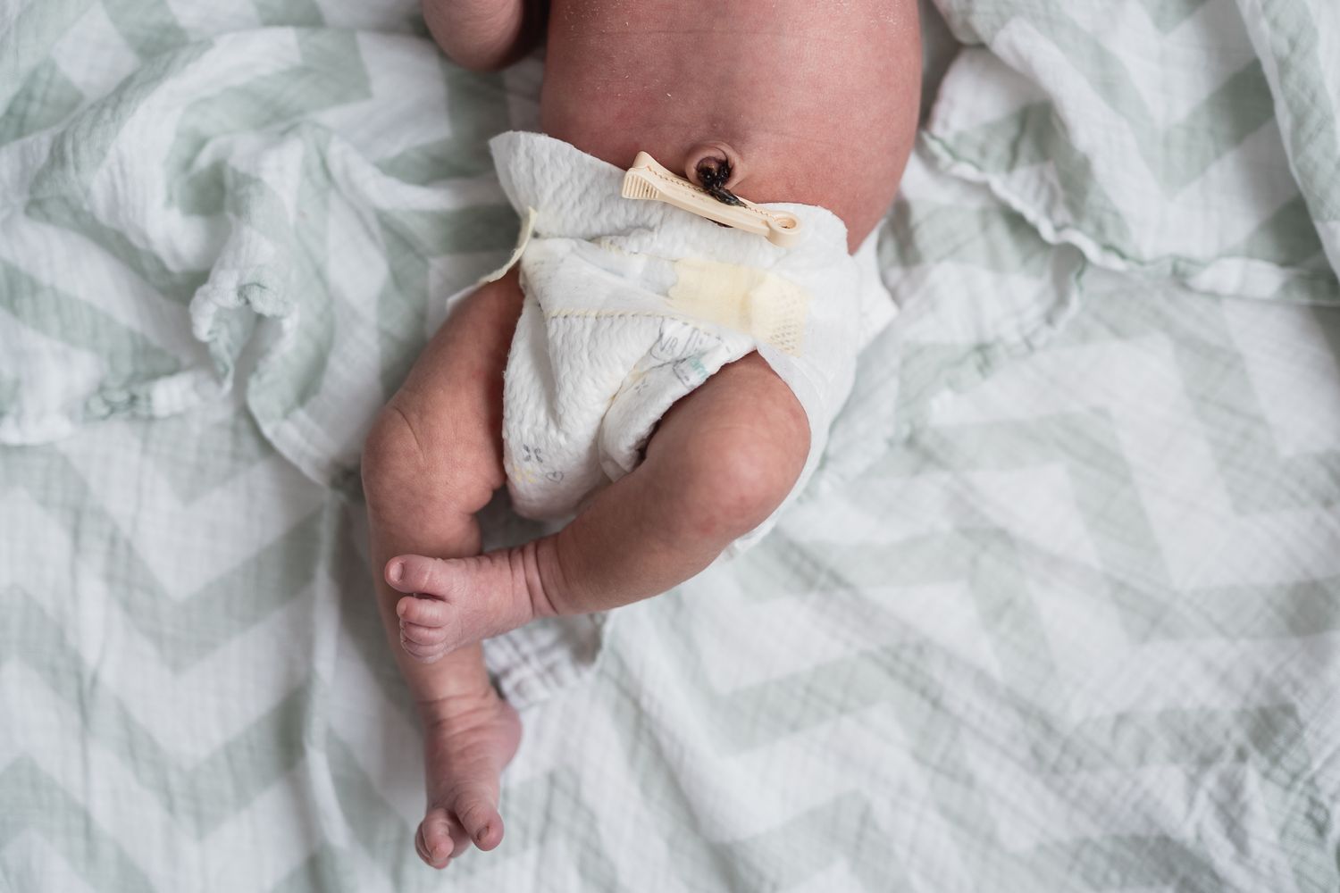 Image of a newborn cropped to show only the waist down to focus on baby's belly