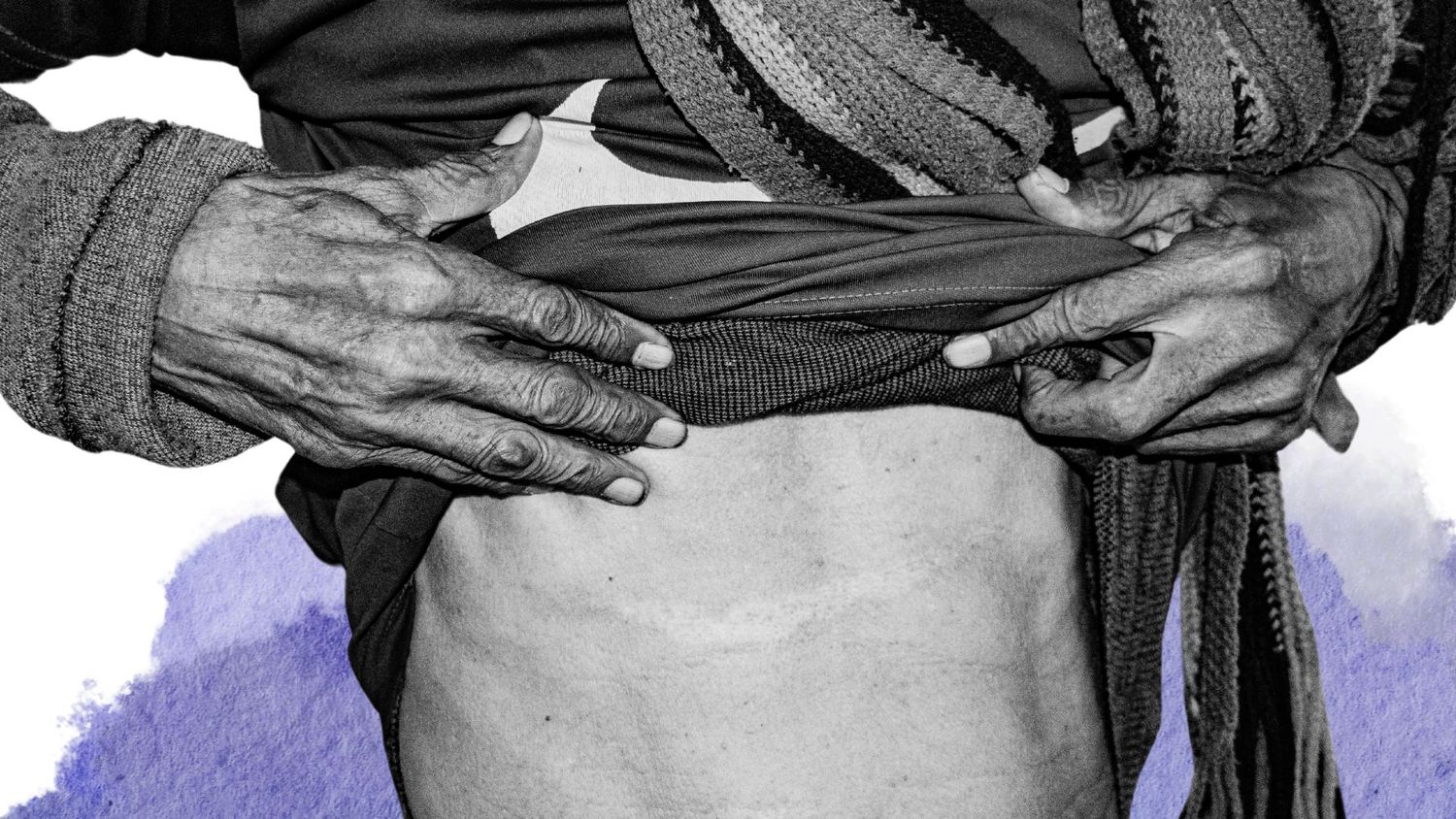 Herida abdominal