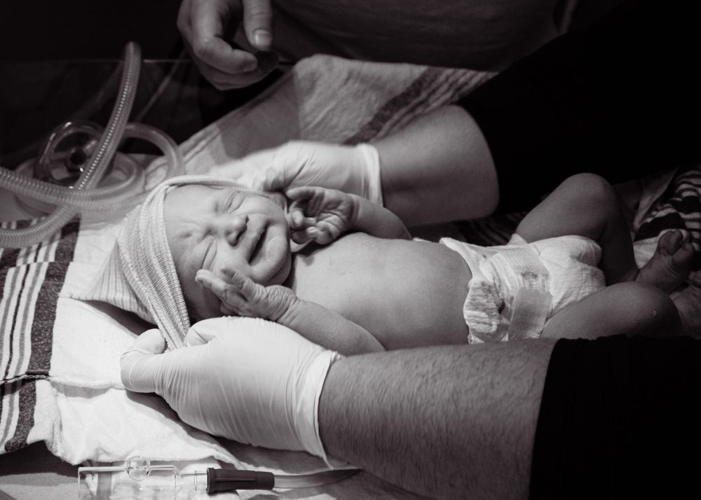 Black and white image of medical team examining newborn immediately after birth.