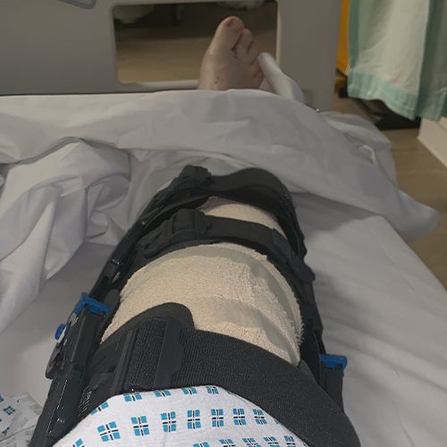 A medical knee brace worn over a hospital gown while lying in a hospital bed.