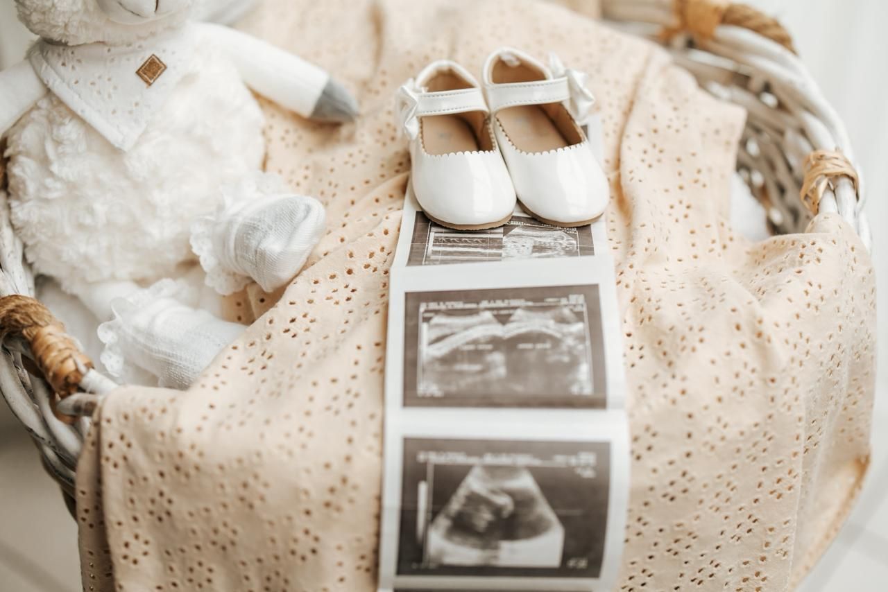Baby shoes, ultrasound photos, and delicate lace fabric arranged in a soft, dreamy pregnancy announcement composition.
