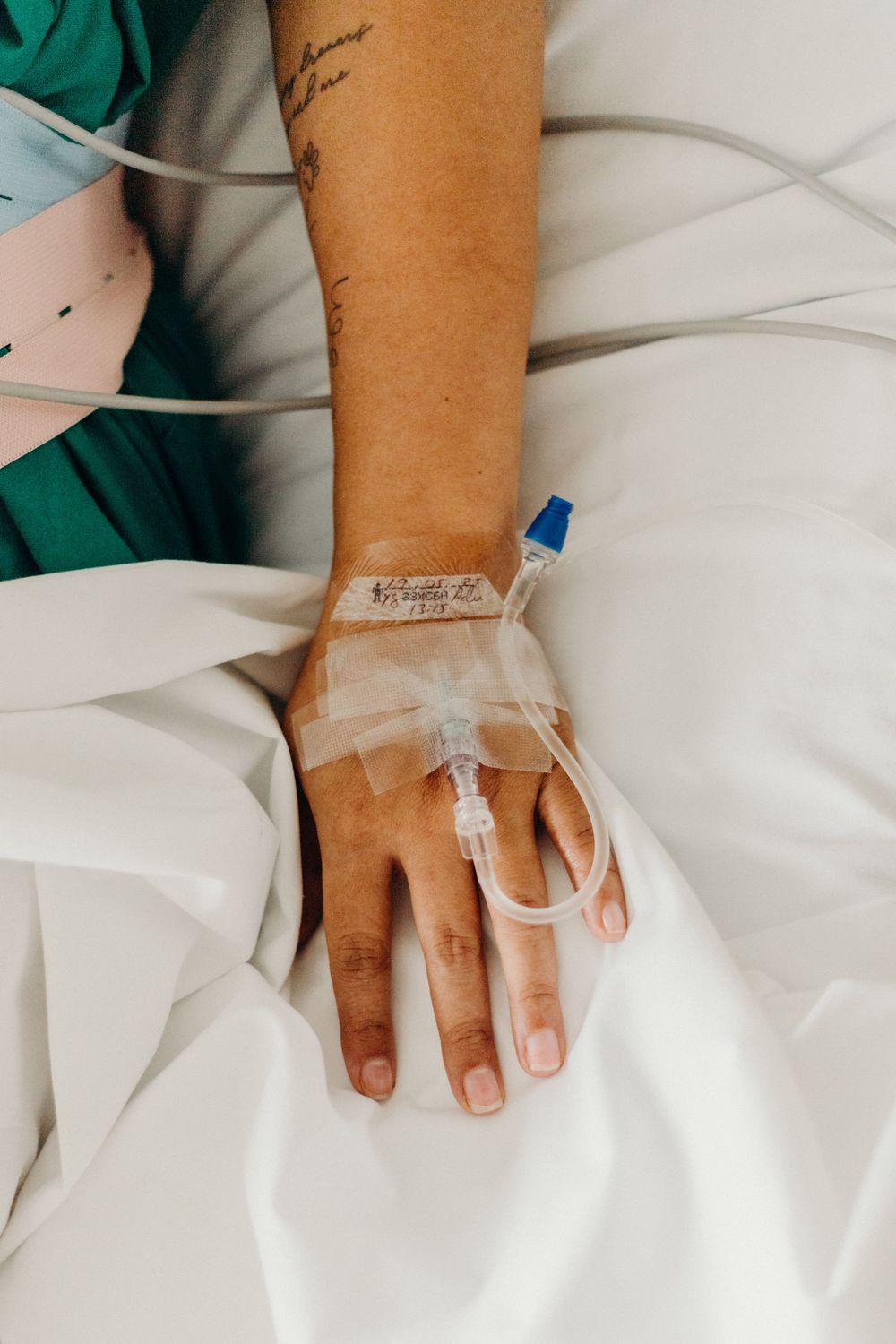 Close-up of a patient's hand with an IV catheter in a hospital setting.
