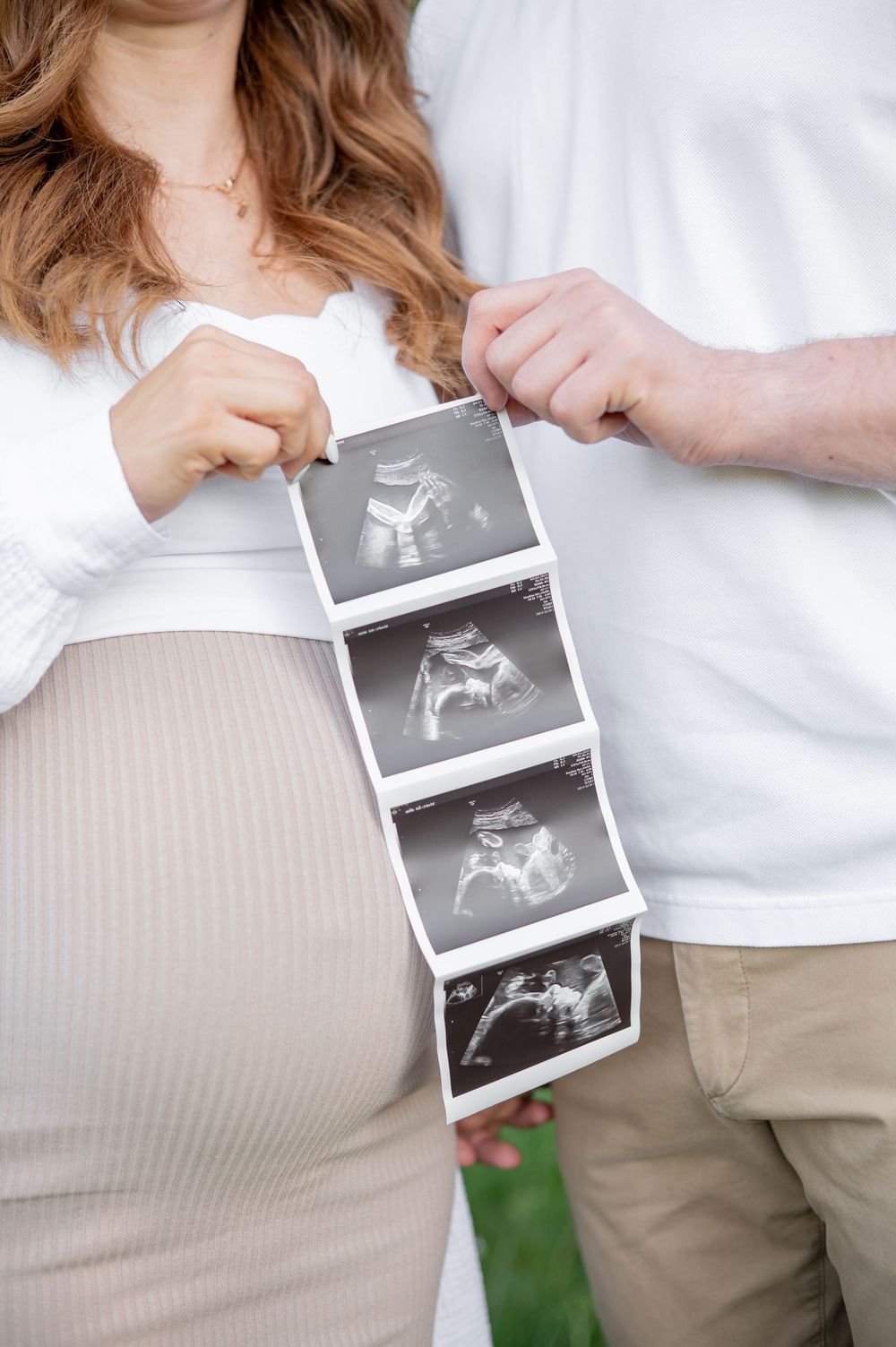 Eine Nahaufnahme von Ultraschallbildern, die einer schwangeren Frau in einem beigen Kleid und einem weißen Oberteil vorgehalten werden.