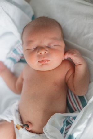 A sleeping newborn baby rests peacefully on white bedding wearing a striped hospital gown.