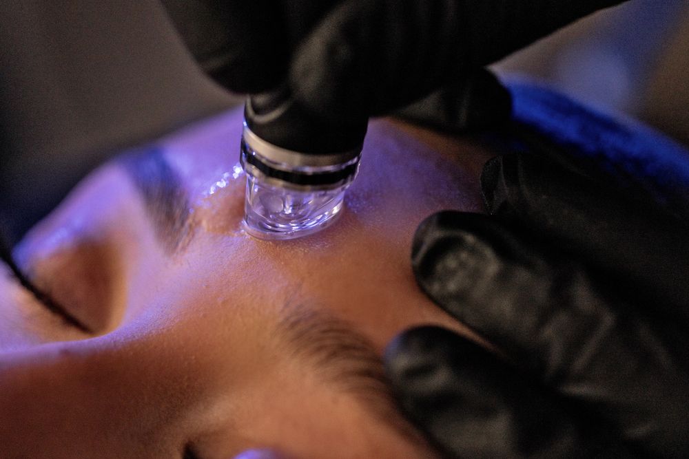 Lymphatic drainage therapy. Platinum Hydrafacial. Red-carpet facial. Lymphatic Drainage treatment in Barrie, Ontario. Medi-spa services.