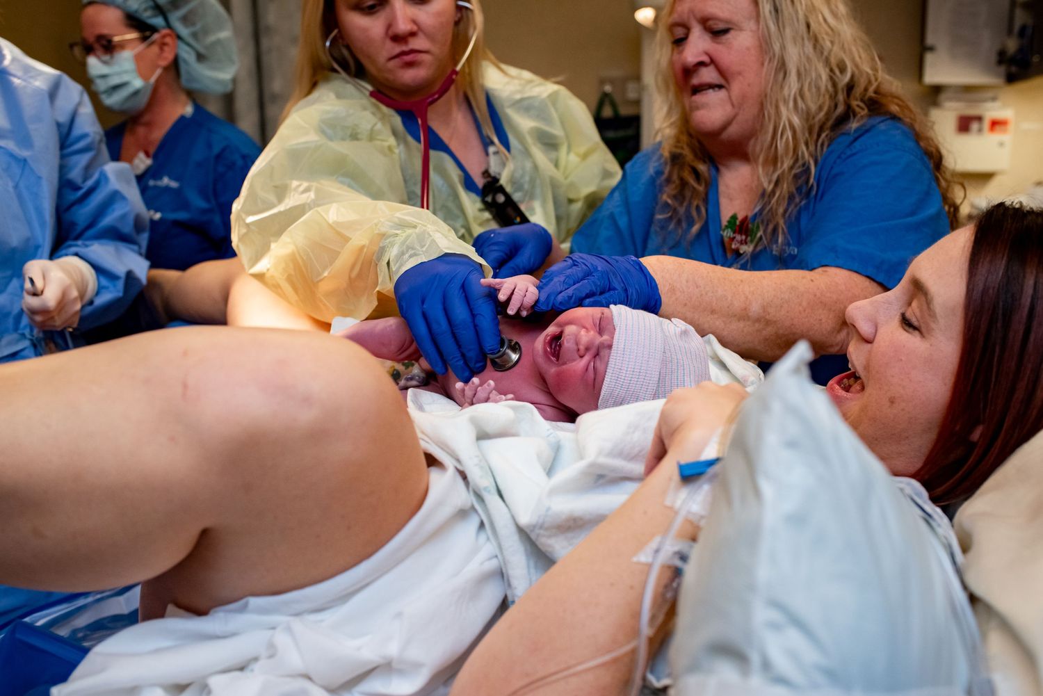 Medical team assists during childbirth as newborn emerges in hospital delivery room.