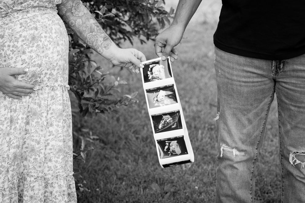 Black and white photo of hands holding ultrasound scan strips showing pregnancy images.