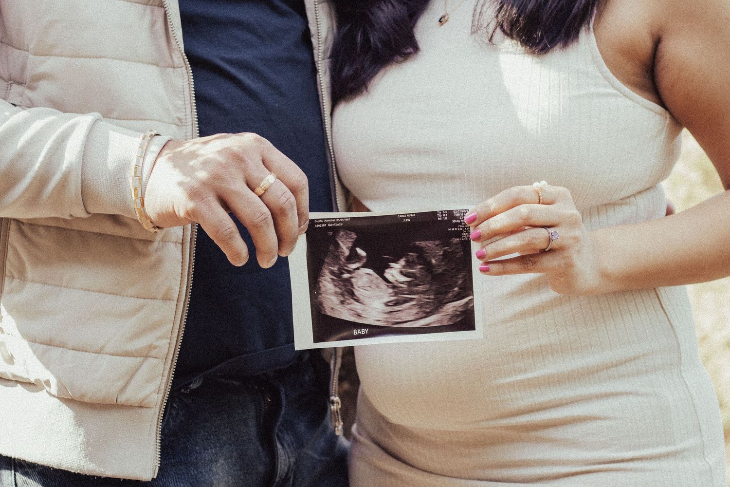 Pregnant couple holding ultrasound sonogram photo showing their unborn baby during maternity photoshoot.