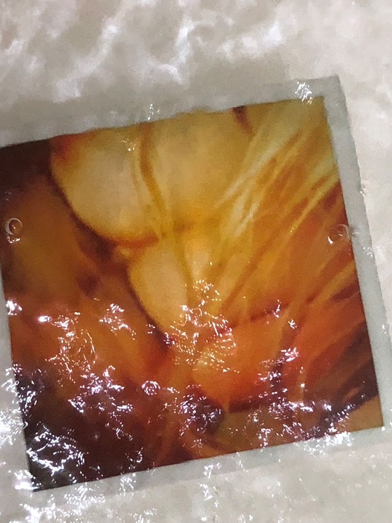 Medical X-ray image showing deep orange and yellow tones with cloudy patterns and anatomical structures.