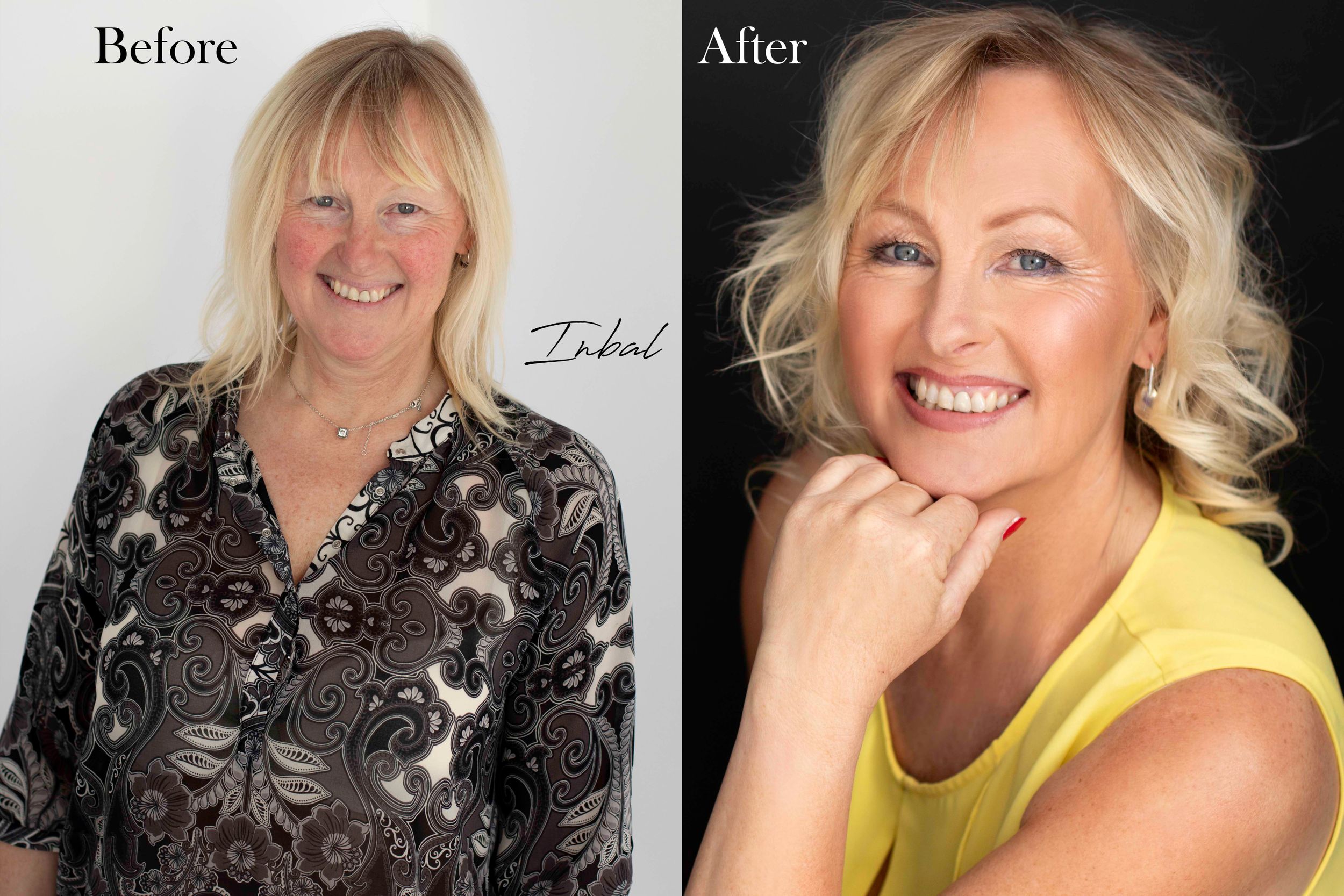 Unbelievable Trenorol Before & After Pics: Real User Results Revealed - z8h6rug