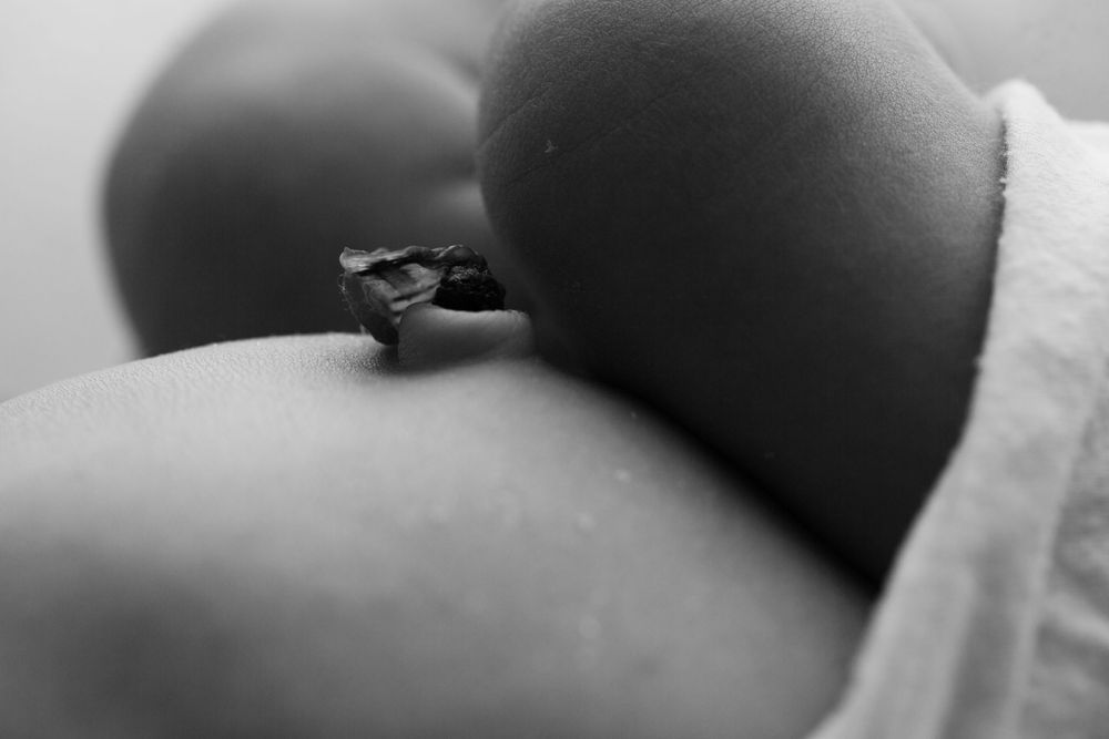 Black and white macro image of baby's umbilical stump.