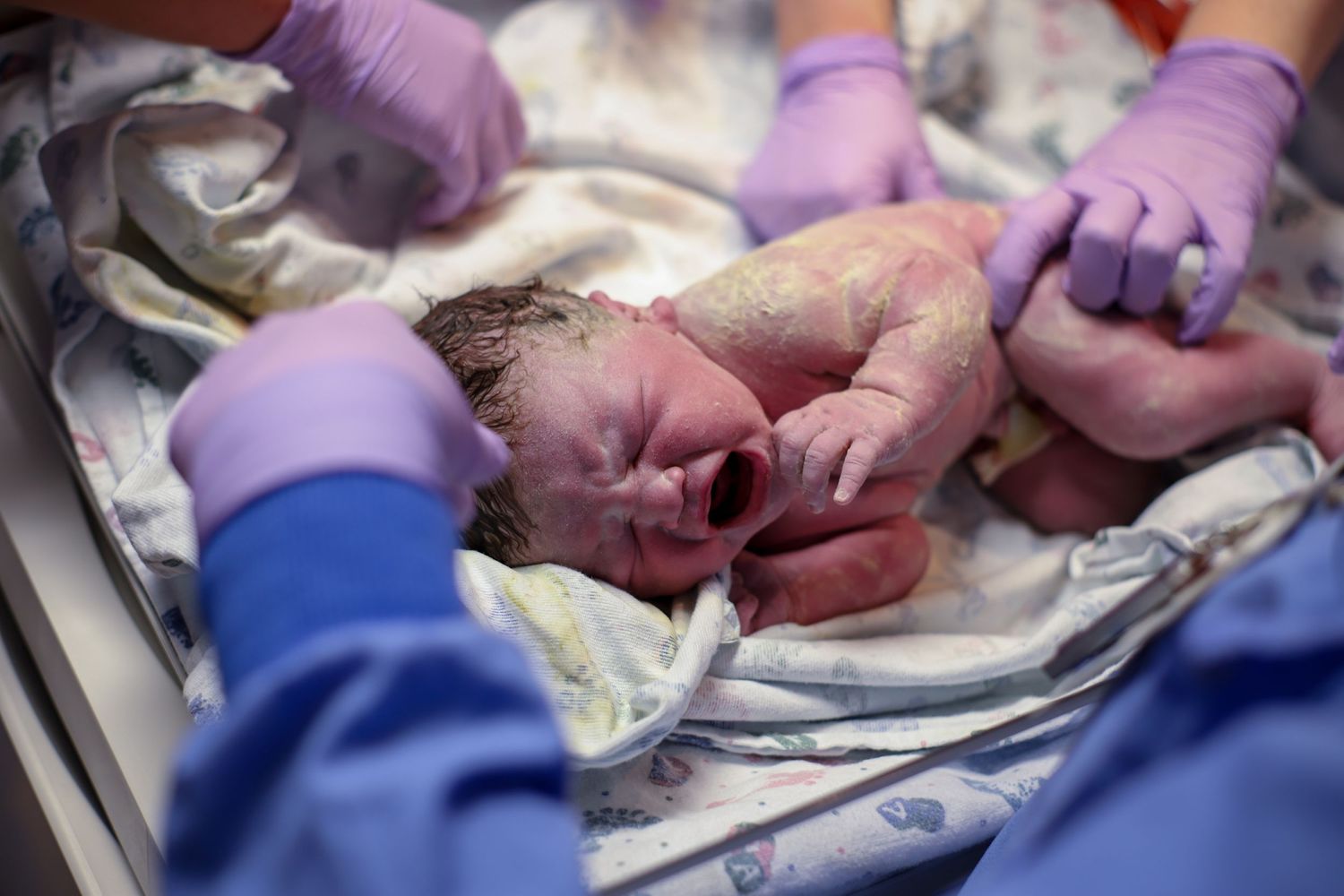 Newborn surrounded by nurses while they clean him just after birth in Sioux City, IA.