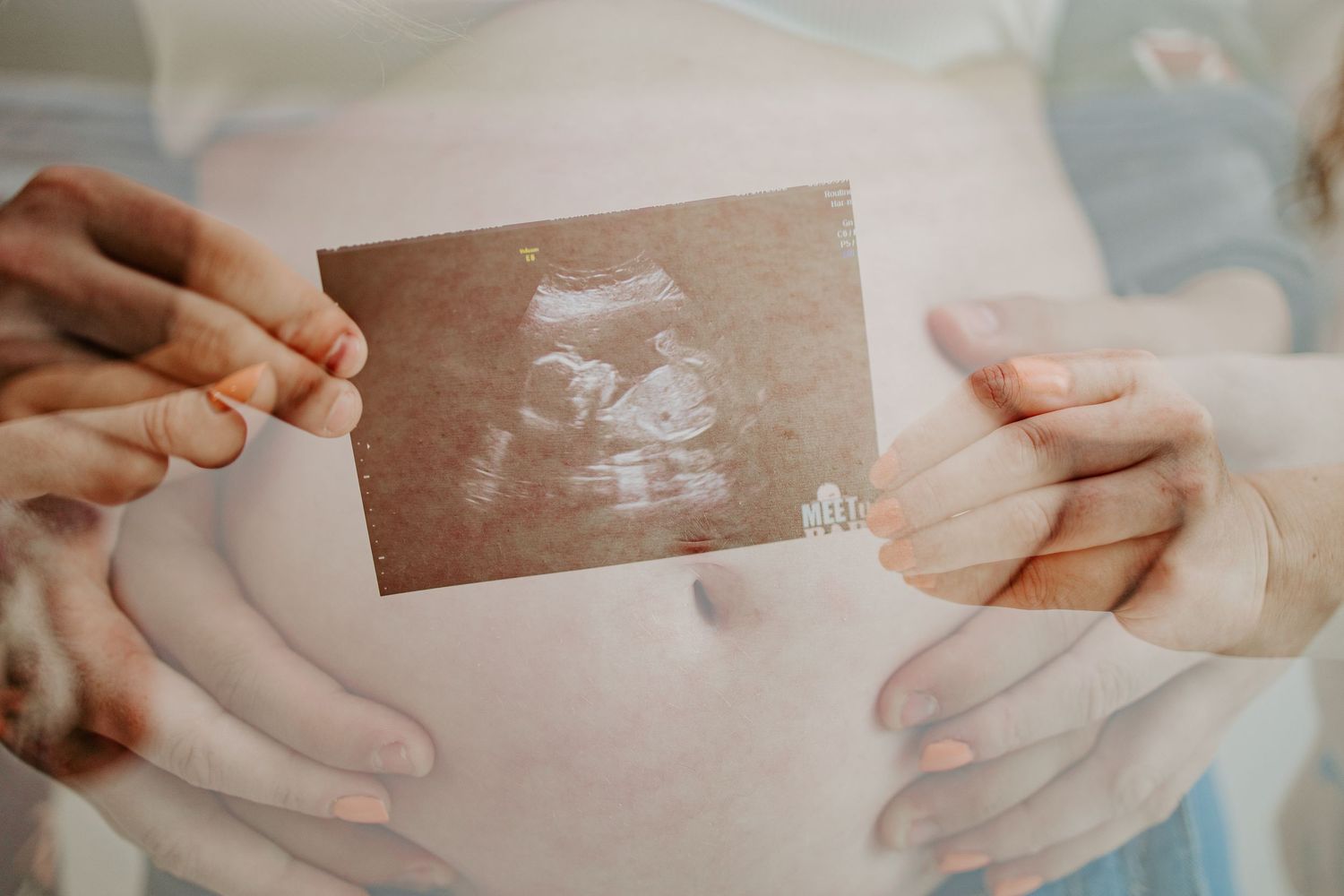 Couple holding ultrasound photo over pregnant belly, capturing a precious prenatal moment together.