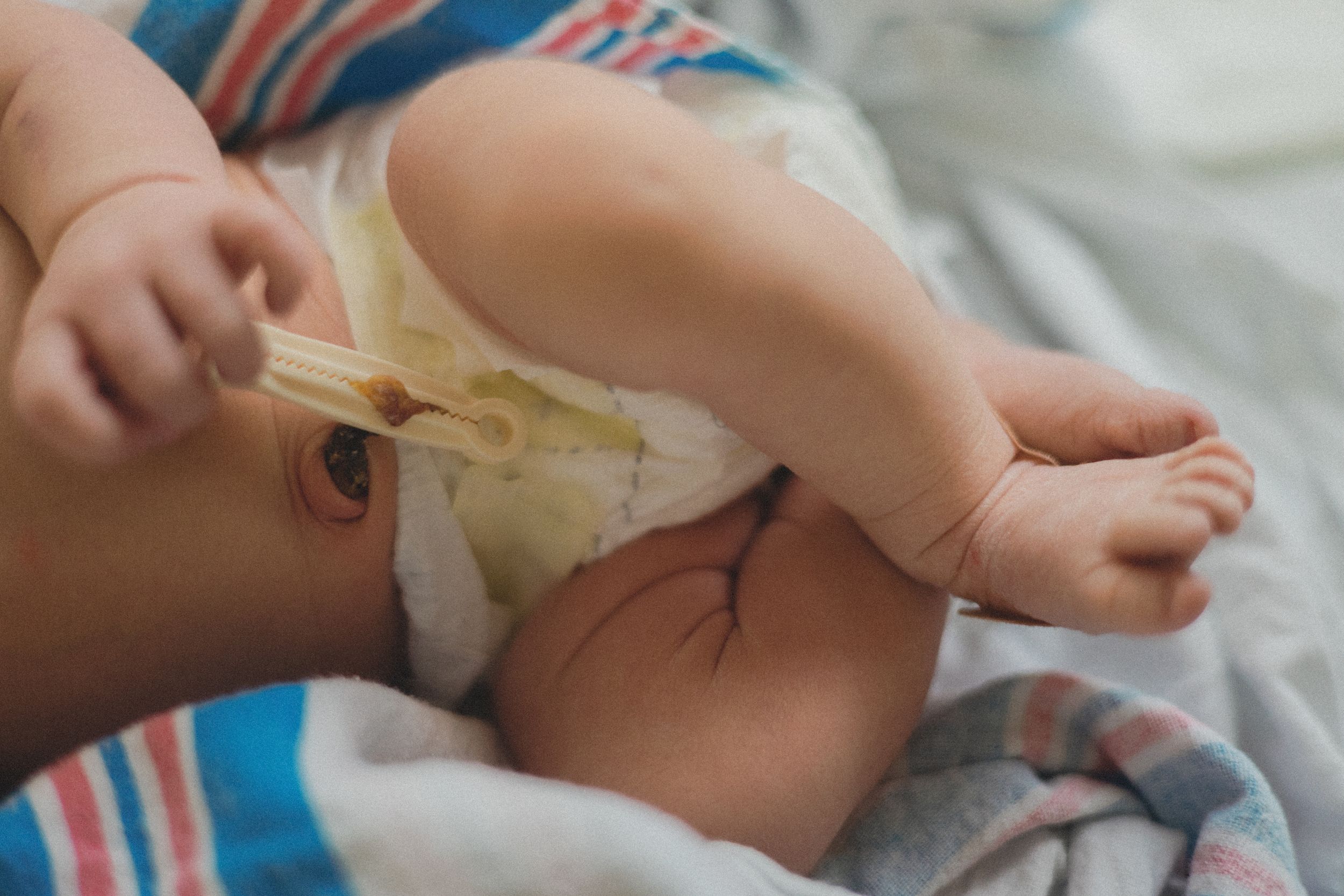 Close-up of a newborn baby's legs and diaper on a striped blanket.