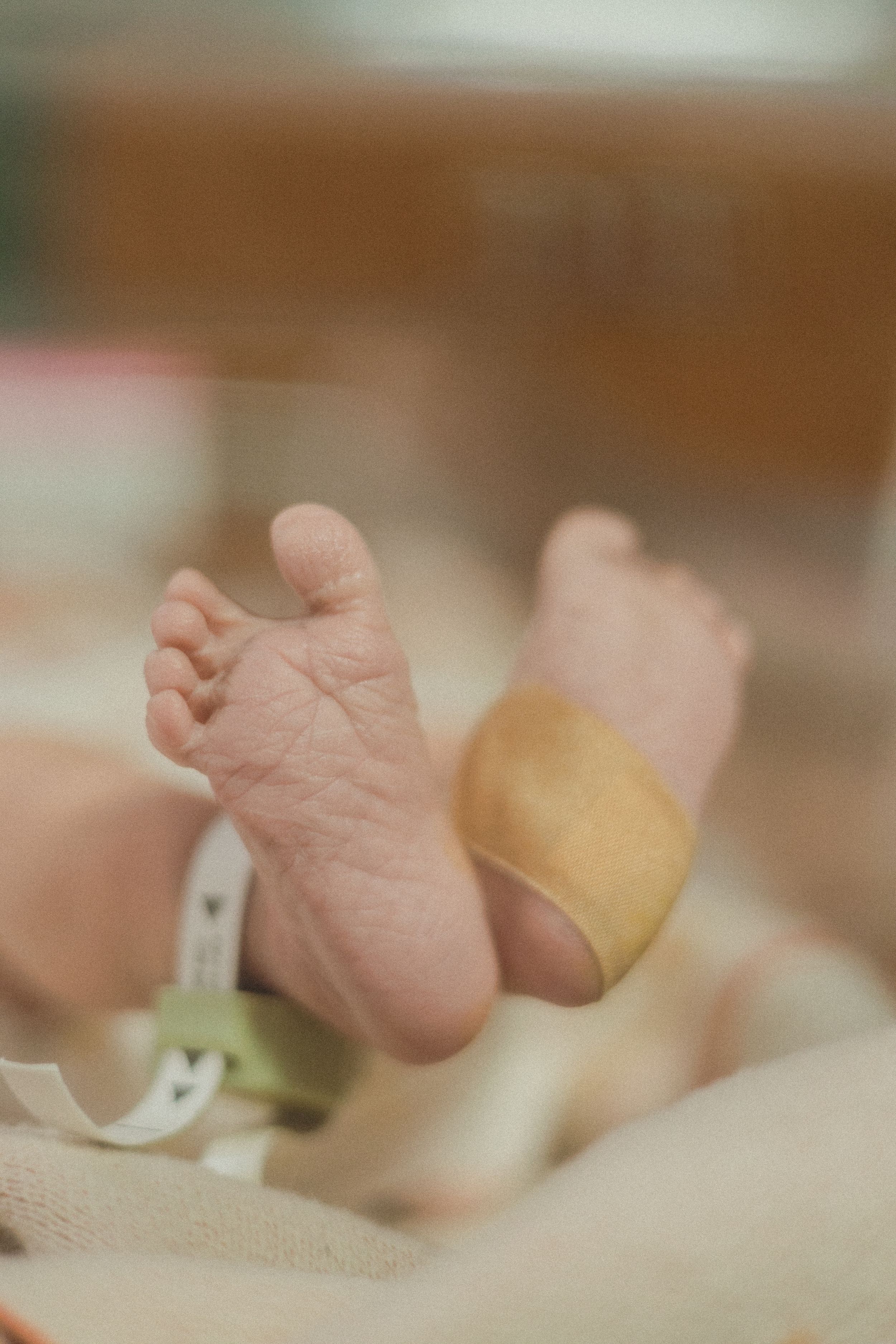 Close-up of newborn baby feet with hospital ID bracelet in delivery room.