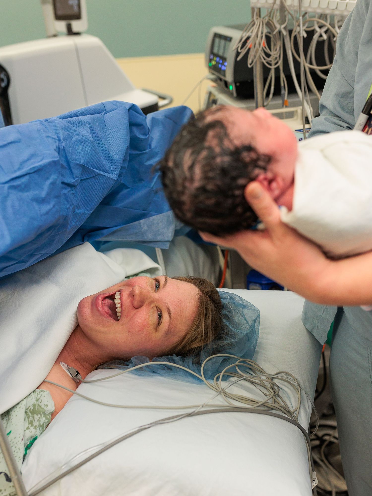 birth photos c section