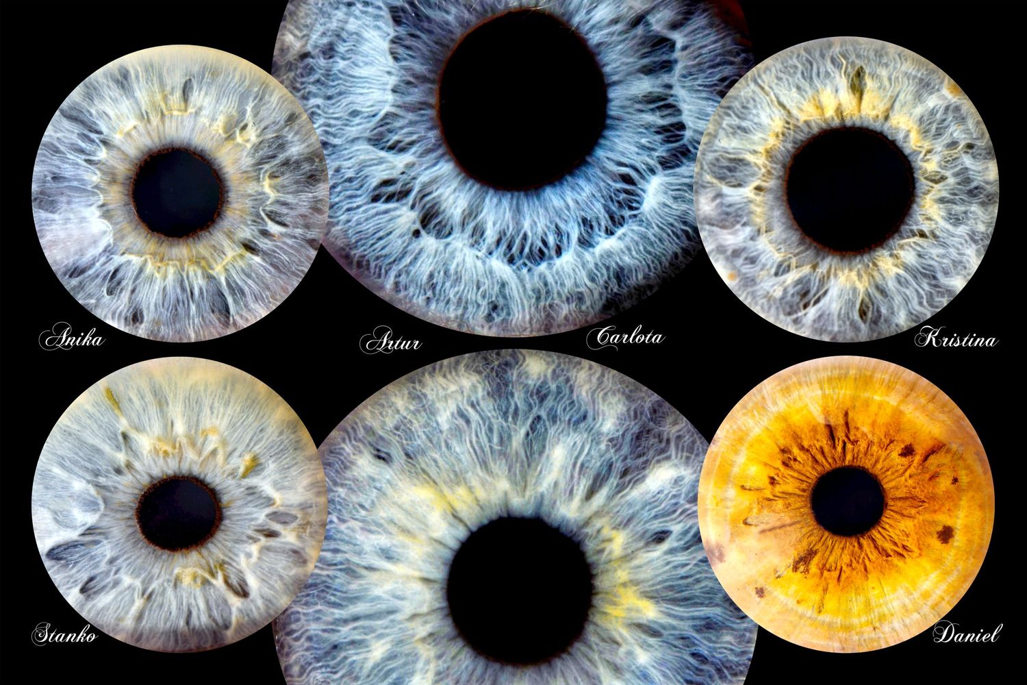 Collection of six detailed iris photographs showing different colors and patterns.