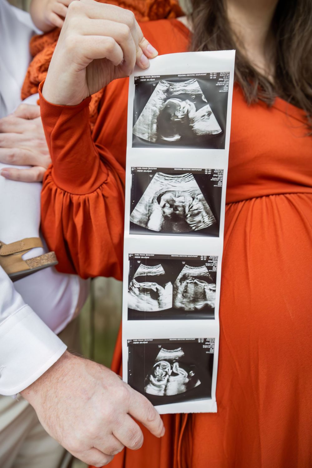 A strip of ultrasound photos showing different views of a developing baby.