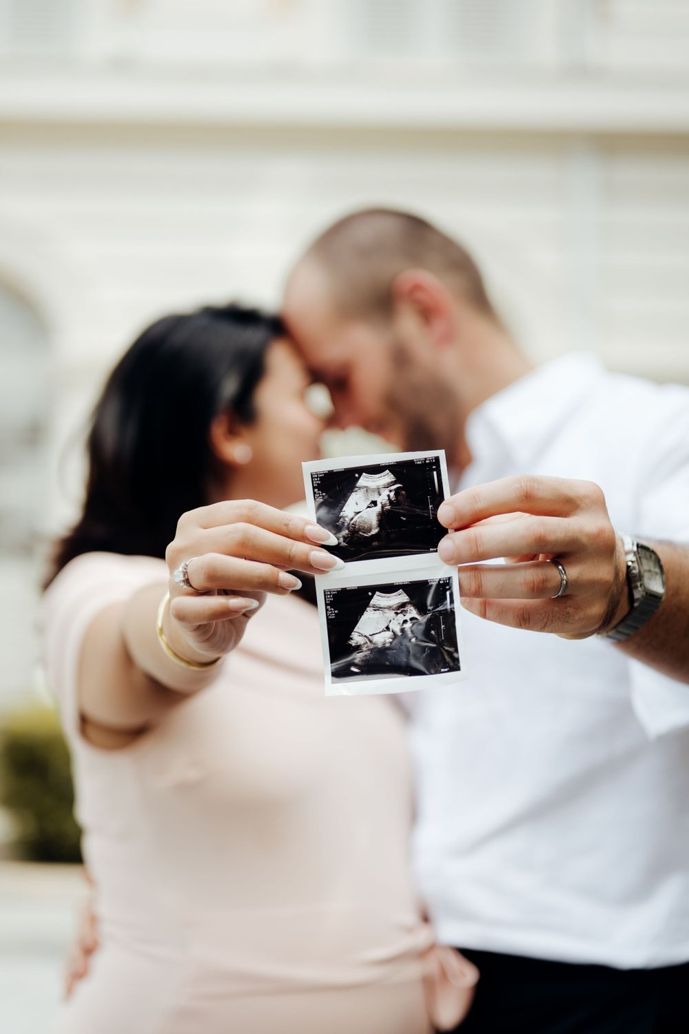 Couple doing a nose to nose pose while showing their ultrasound of their baby