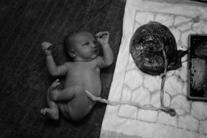 Preserving the miracle of birth: Birth photography capturing the raw emotions, incredible moments, and the beginning of