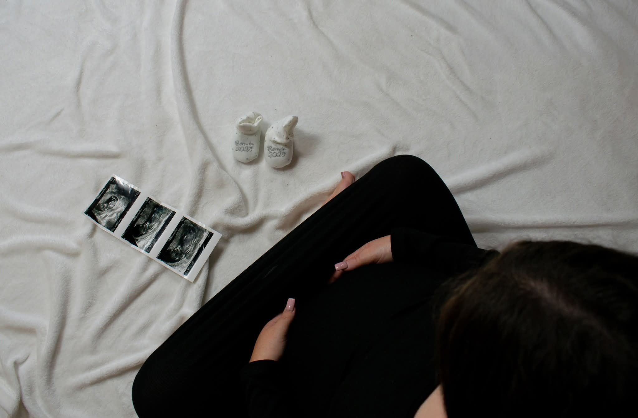Overhead view of pregnant woman lying down with ultrasound scans and tiny baby shoes nearby.
