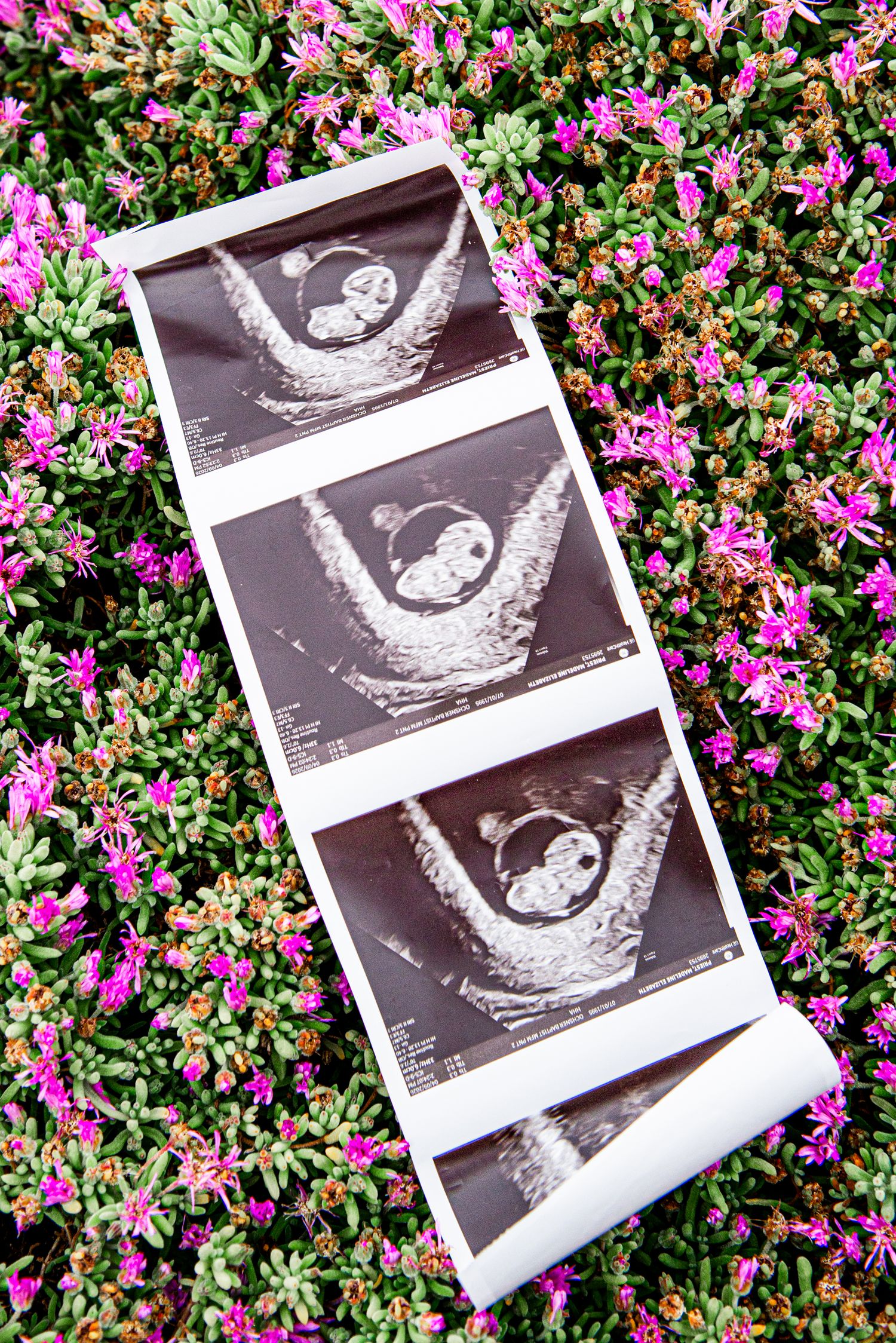 Ultrasound sonogram strip of a baby resting on pink flowering plants outdoors.