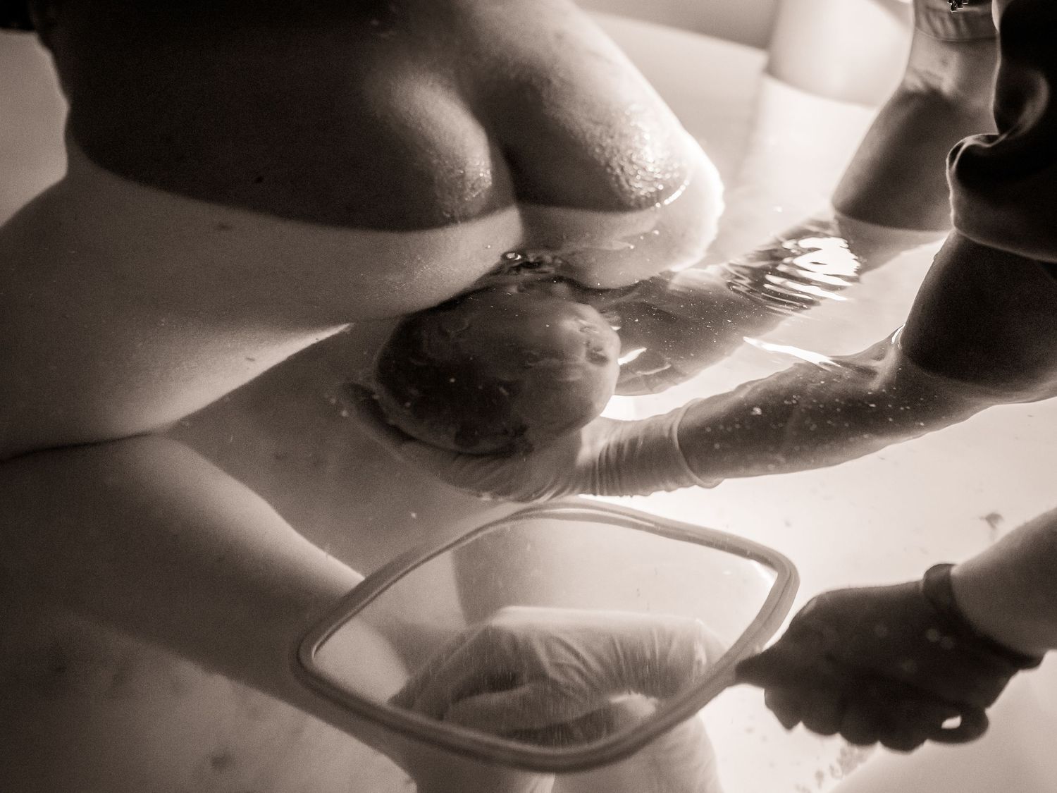 Black and white image of a water birth in progress.