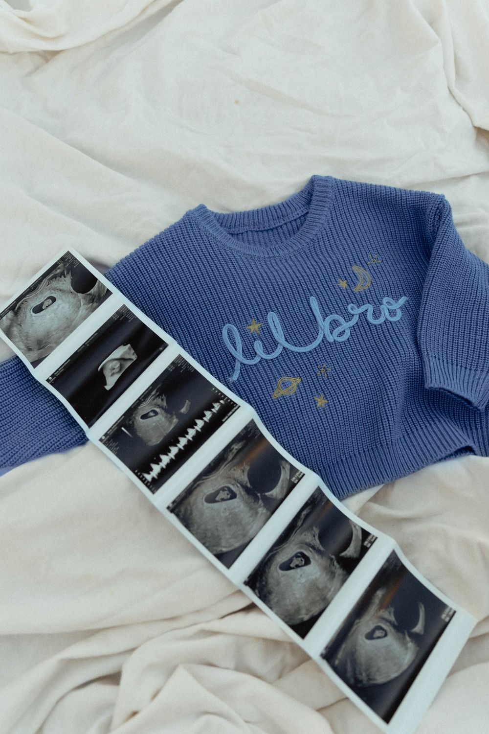 Blue baby sweater and ultrasound photos arranged on white fabric background.