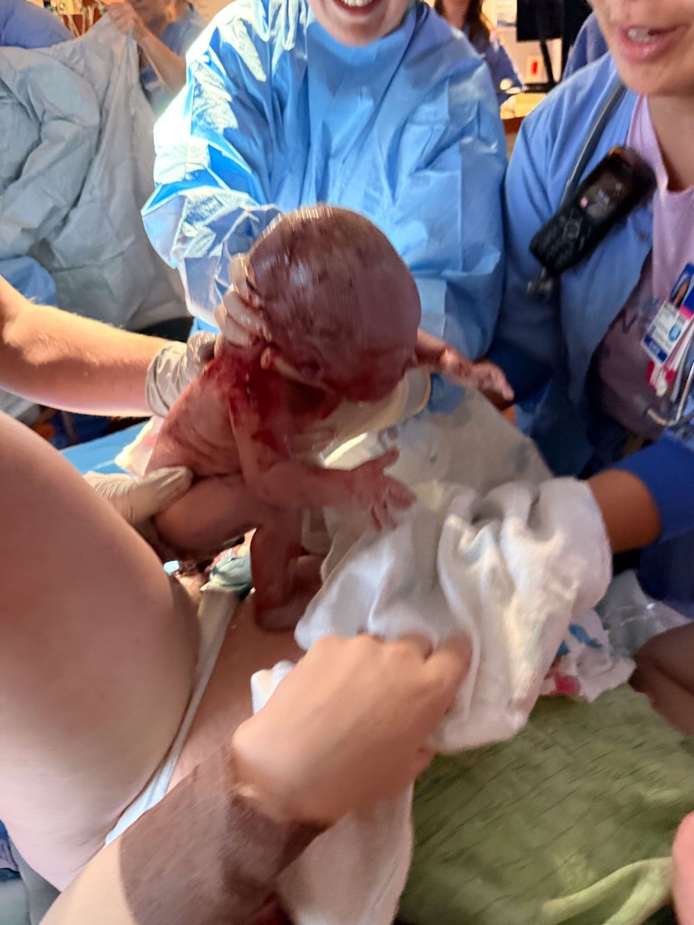 Newborn baby being delivered by medical team in hospital delivery room.