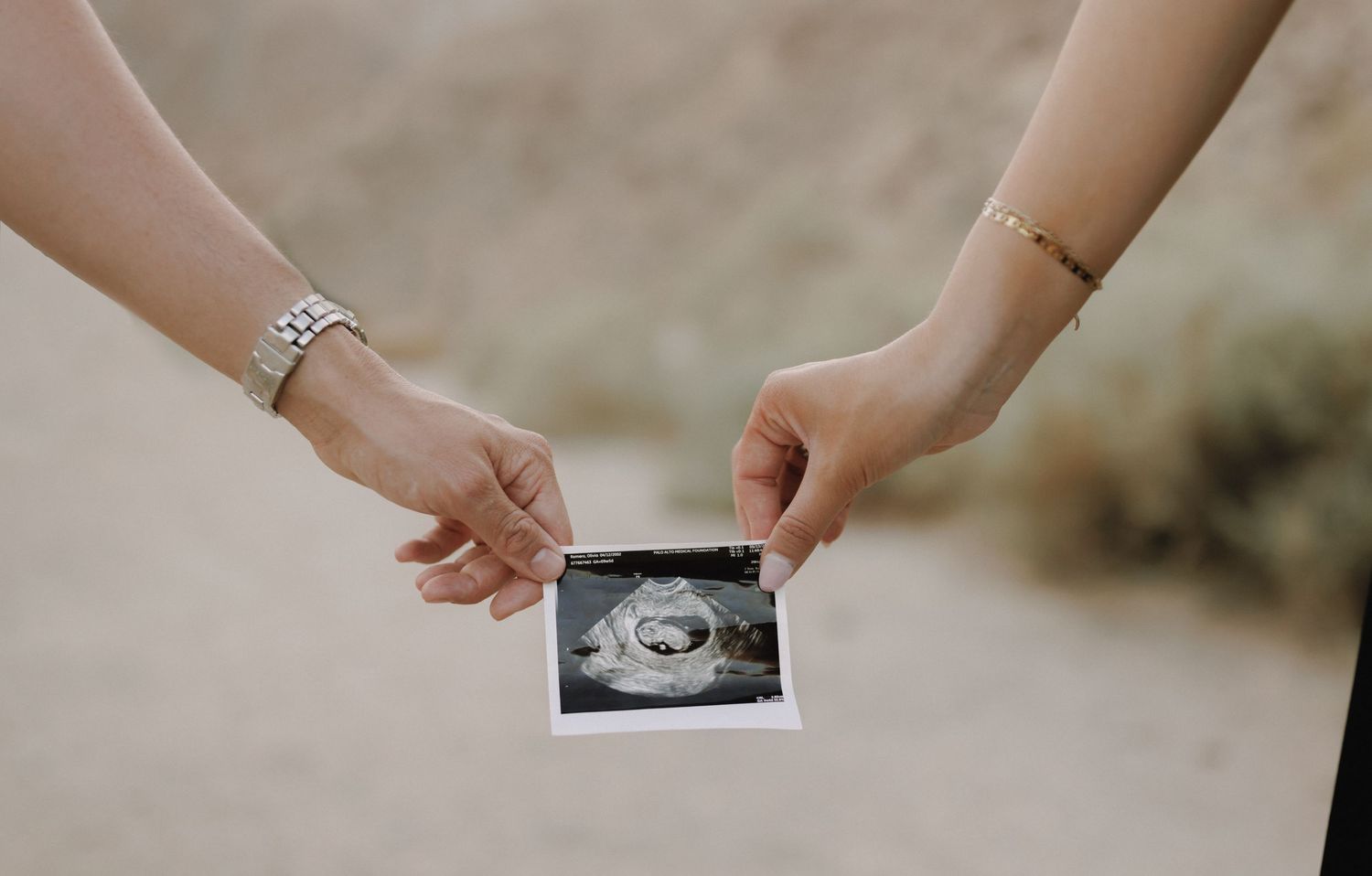 Two people holding an ultrasound photo together, announcing pregnancy with a tender moment captured outdoors.