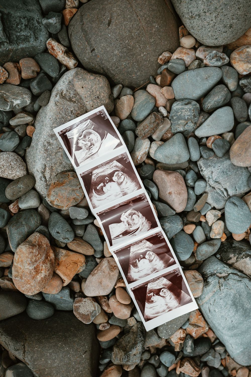 A strip of four ultrasound sonogram photos laid on smooth river rocks, showing fetal images in black and white.