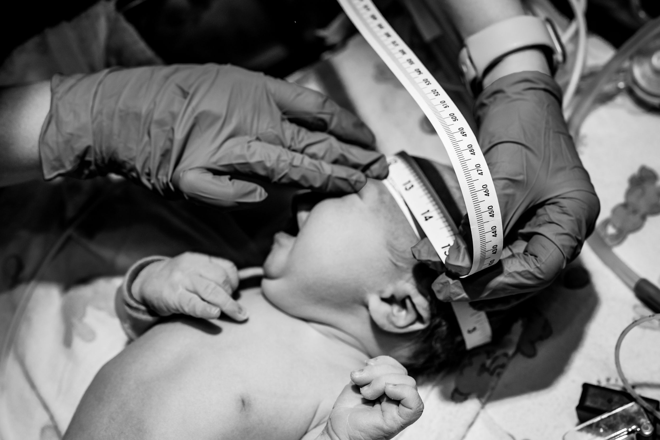 Nurse measuring newborn baby's head circumference with a tape measure.