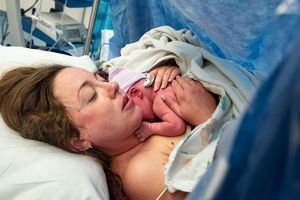 Mother receiving newborn baby on chest immediately after cesarean section delivery in hospital.
