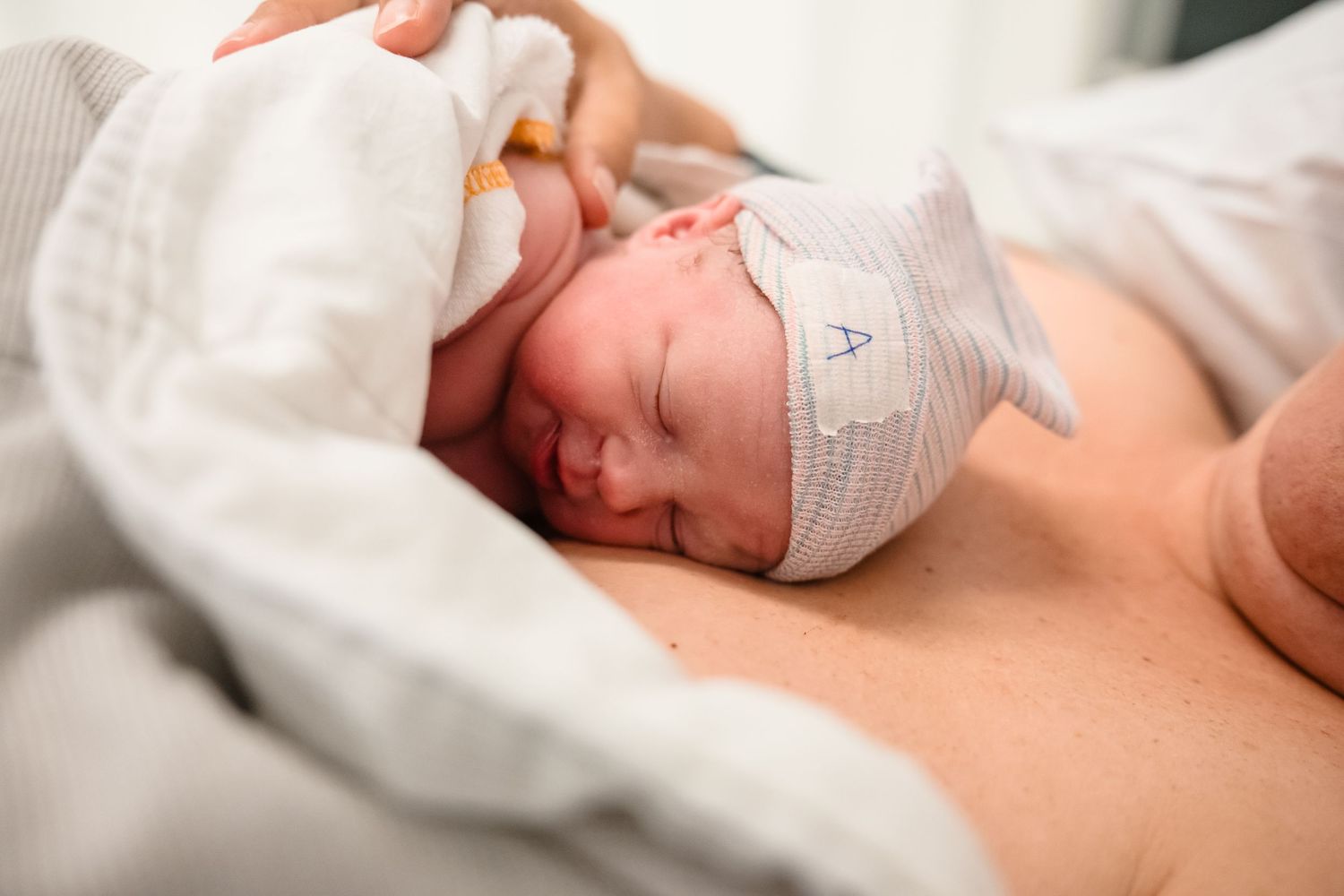 Hier zie je een foto van een kindje dat na de keizersnede lekker bij mama op de borst ligt.
