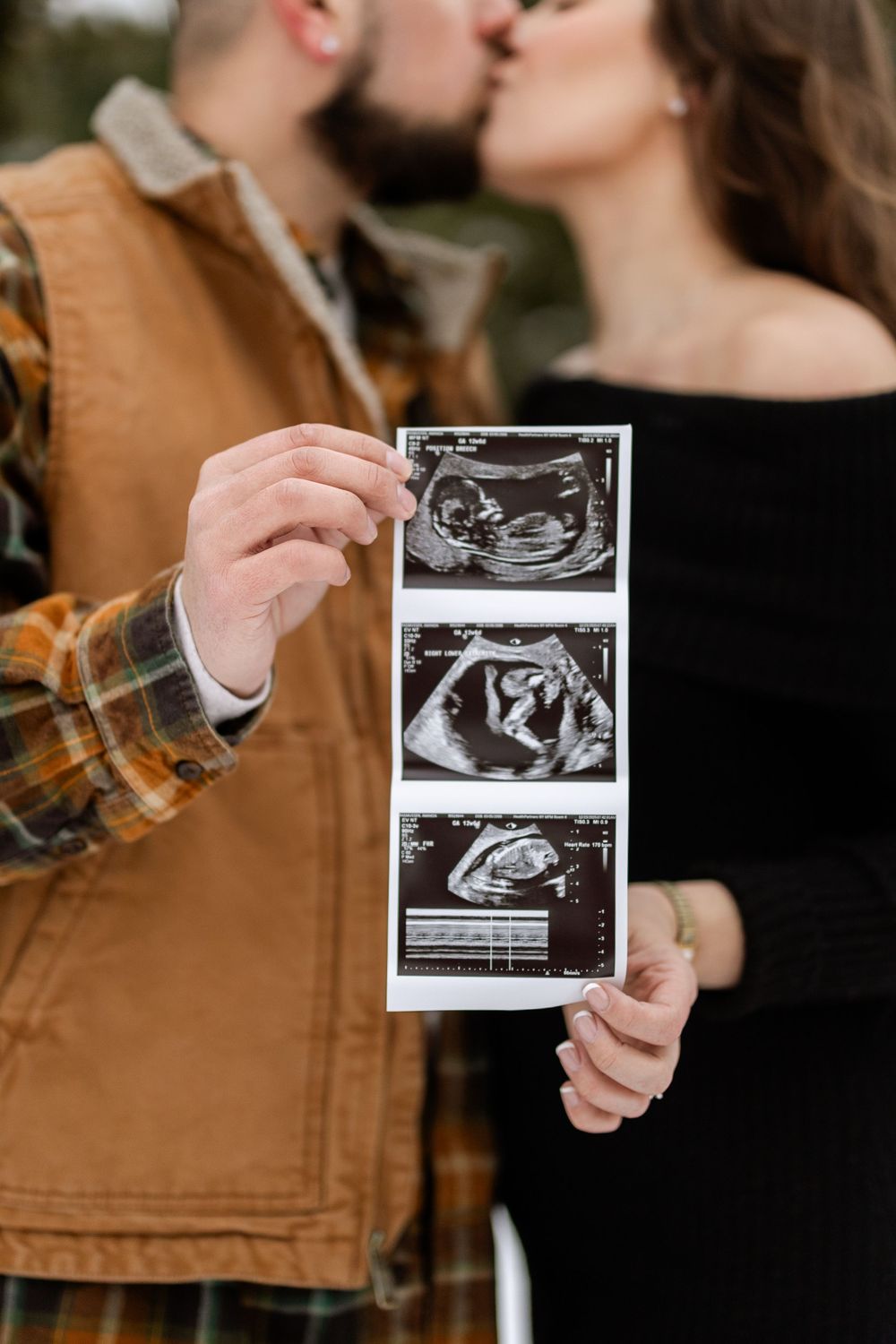 Close-up shots of hands holding ultrasound images while wearing a brown jacket against dark background.