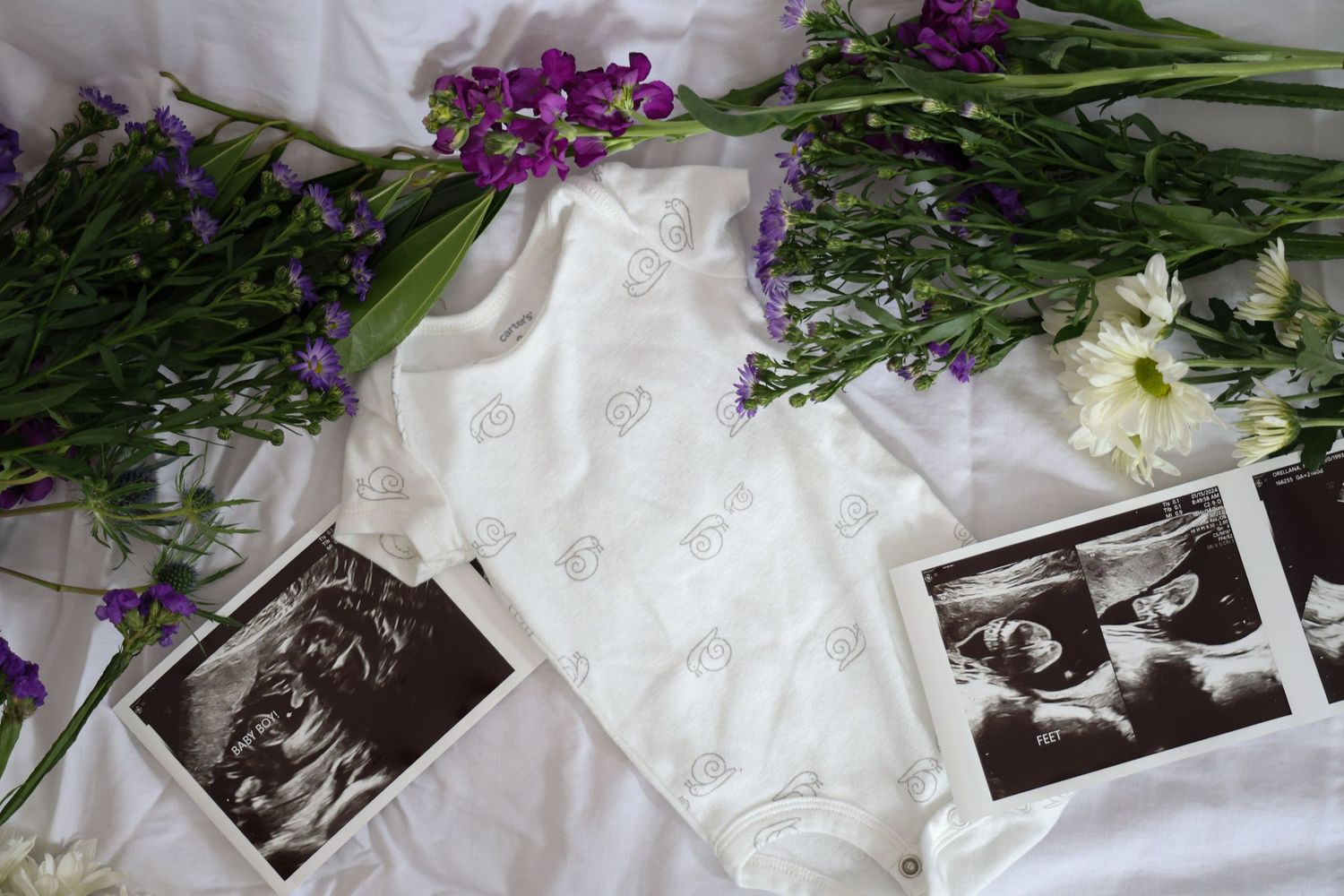 Baby onesie with ultrasound photos and purple flowers on white.