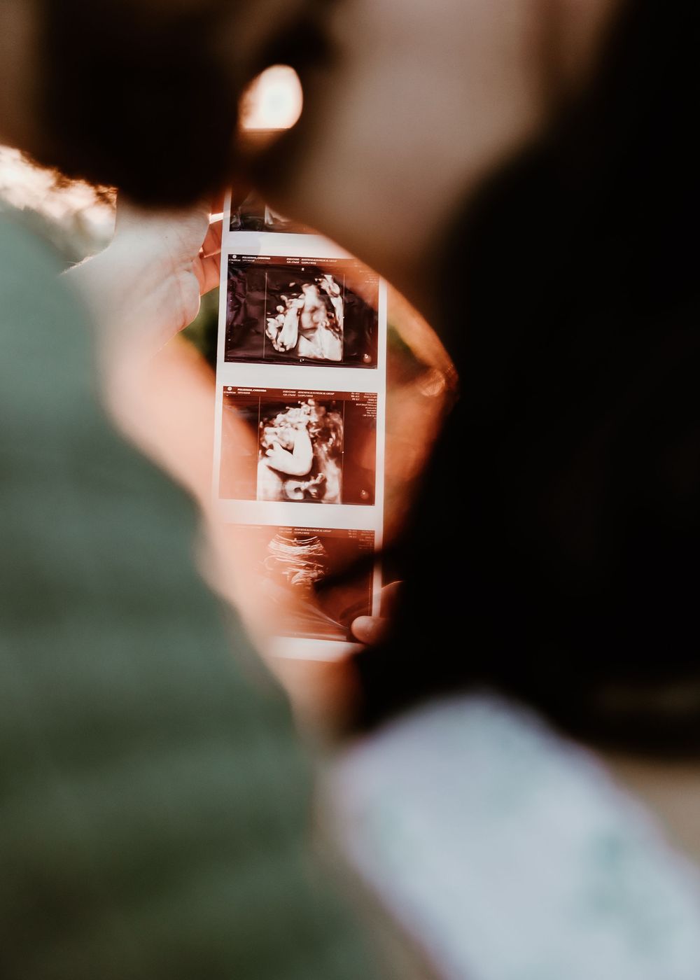 Hands holding ultrasound photos in artistic shallow depth of field.