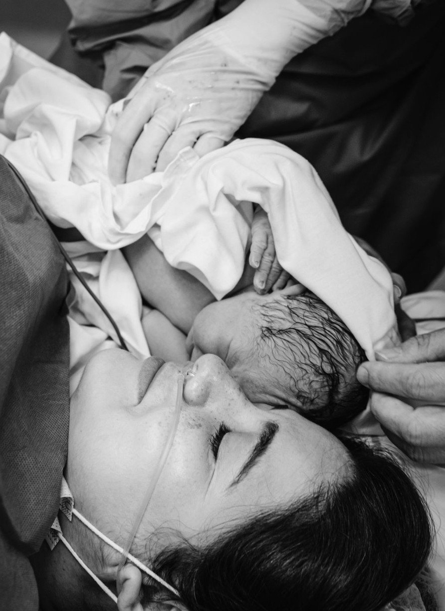 Black and white photograph showing a newborn baby being placed on mother's chest immediately after birth.