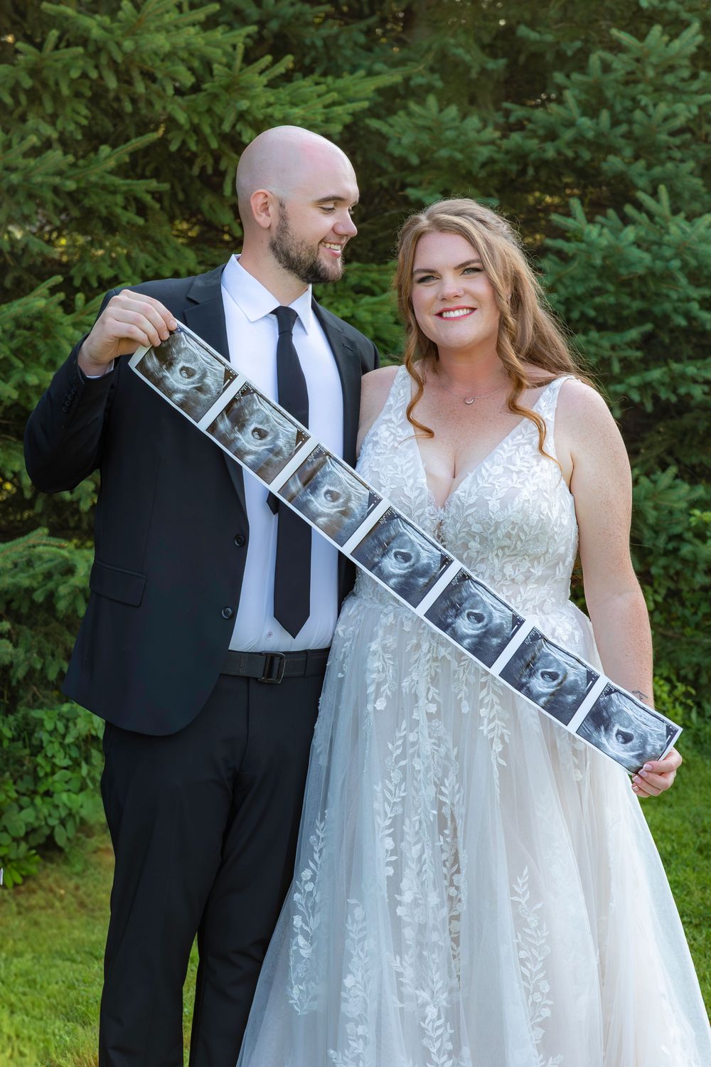 Newlywed couple in wedding attire pose outdoors while holding a strip of ultrasound photos in front of evergreen trees.
