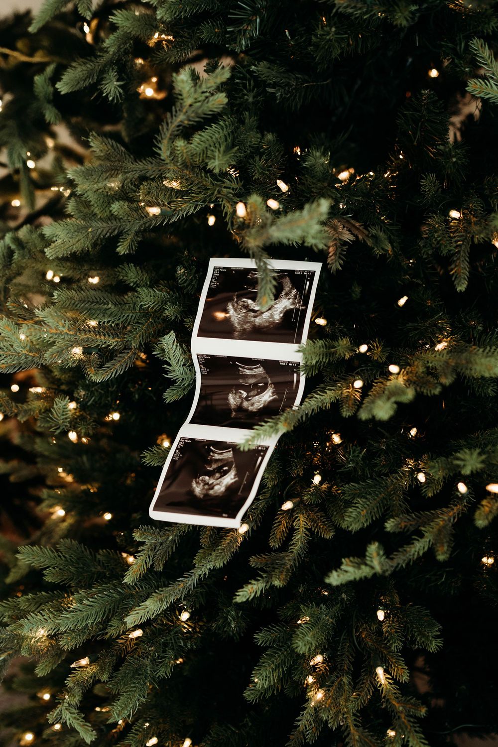 Strip of sonogram ultrasound photos hanging on a lit Christmas tree with twinkling lights and green branches.