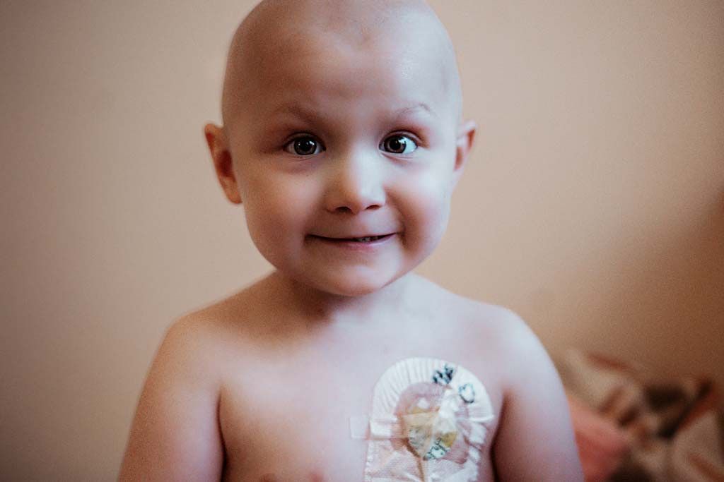 Smiling bald child with a medical port sticker on their chest.