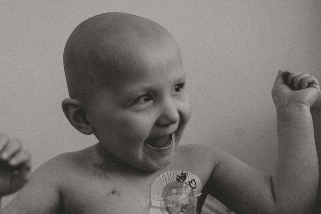 Black and white photo of a bald child laughing with a medical patch.