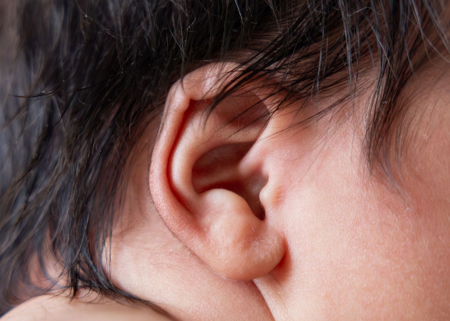 A series of close-up photos showing different angles of a person's ear.