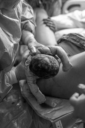 How much is birth photography, Northern Colorado Birth Photography, Johnstown Birth Photography, Windsor Birth Photographer