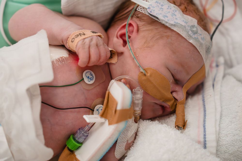 Stichting Earlybirds, kraamtijd reportage, documentaire fotografie, newborn, Wereld prematuren dag, prematuur