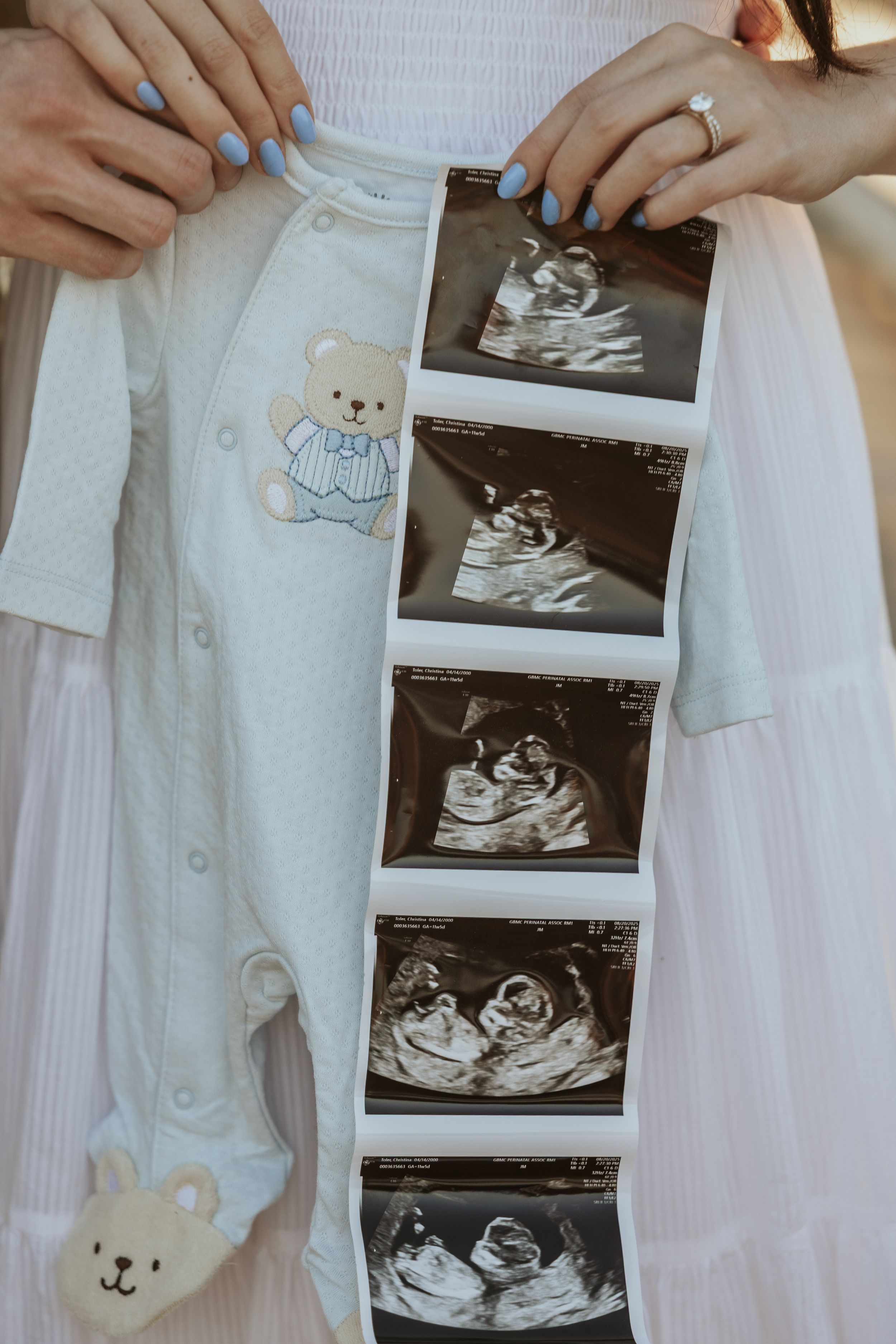 Baby onesie with teddy bear design displayed alongside ultrasound photos showing pregnancy progression.