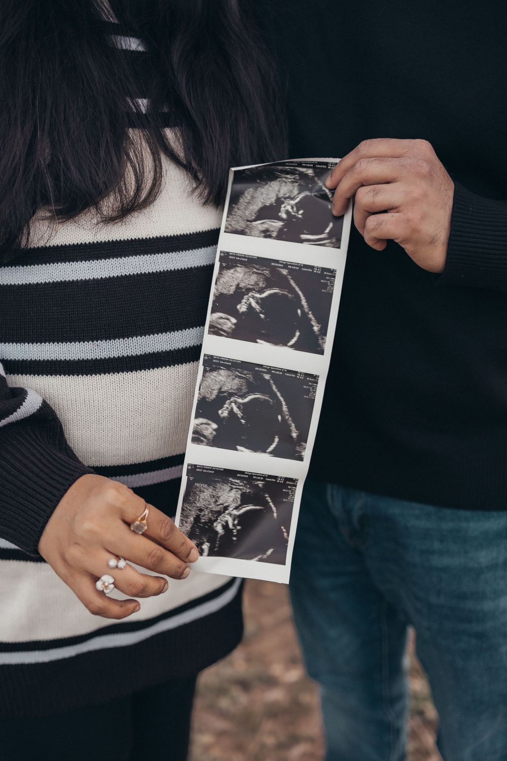 Hands hold a strip of ultrasound images while wearing striped and dark clothing.