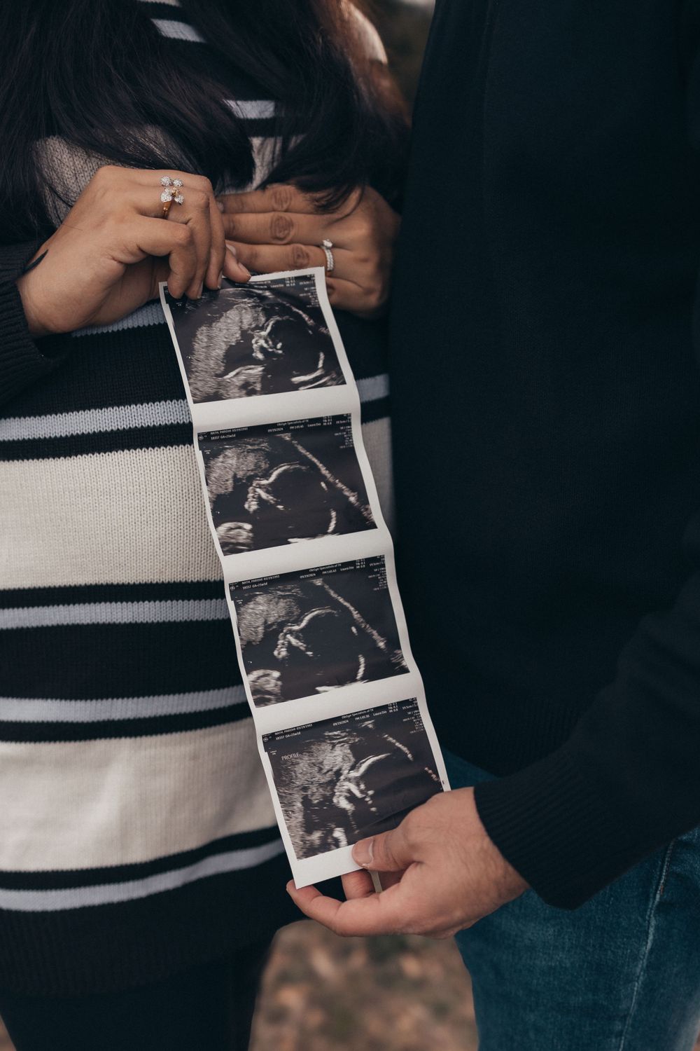 Multiple hands hold a strip of ultrasound photos showing a developing baby.